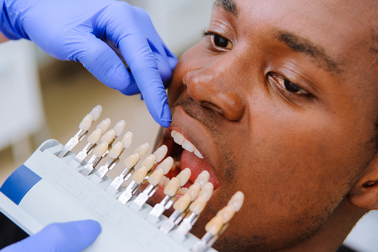 An adult male with a toothbrush in his mouth, being attended to by another person wearing blue gloves.