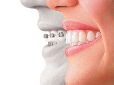 The image shows a split-screen comparison of a person s face with a dental implant on one side and a natural tooth on the other, highlighting the difference between the two.